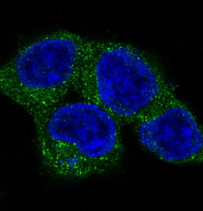 ULK1 Antibody in Immunocytochemistry (ICC/IF)