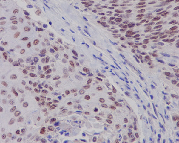 Estrogen Receptor beta Antibody in Immunohistochemistry (Paraffin) (IHC (P))