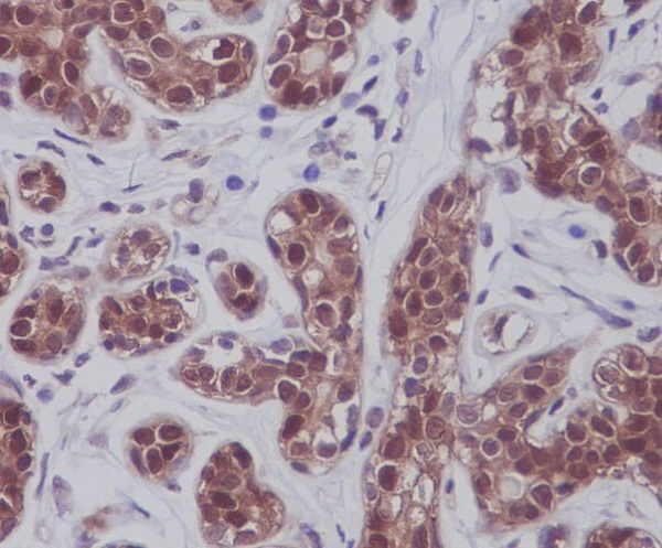 STAT5 alpha/beta Antibody in Immunohistochemistry (Paraffin) (IHC (P))