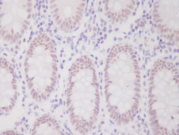 hnRNP C1/C2 Antibody in Immunohistochemistry (Paraffin) (IHC (P))
