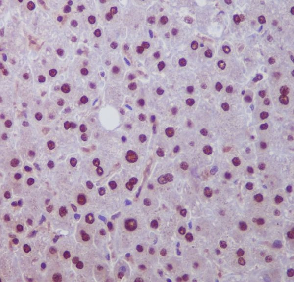 HES1 Antibody in Immunohistochemistry (Paraffin) (IHC (P))