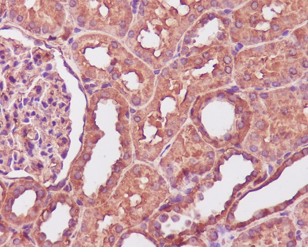Calmodulin Antibody in Immunohistochemistry (Paraffin) (IHC (P))