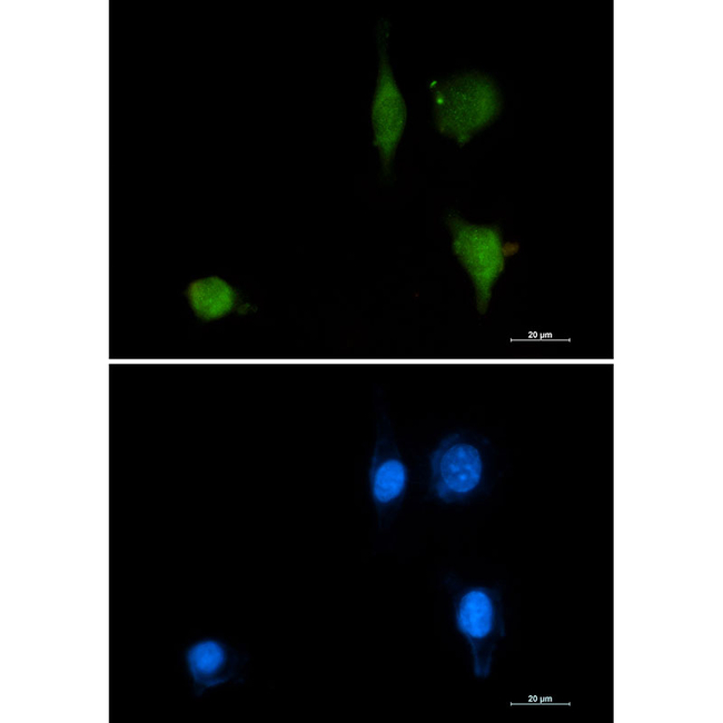 Phospho-delta Catenin (Tyr228) Antibody in Immunocytochemistry (ICC/IF)