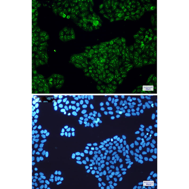 Calretinin Antibody in Immunocytochemistry (ICC/IF)