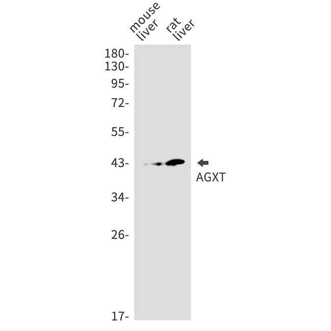 AGXT Antibody in Western Blot (WB)