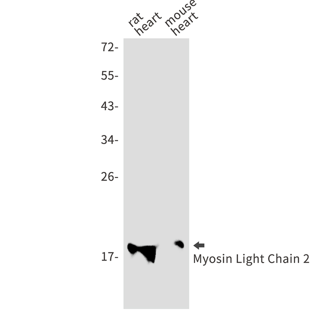 MYL2 Antibody in Western Blot (WB)