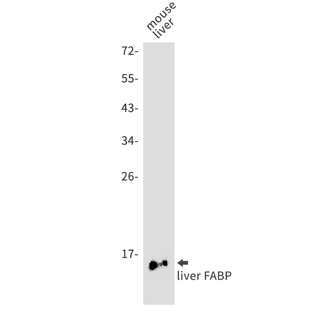 FABP1 Antibody in Western Blot (WB)
