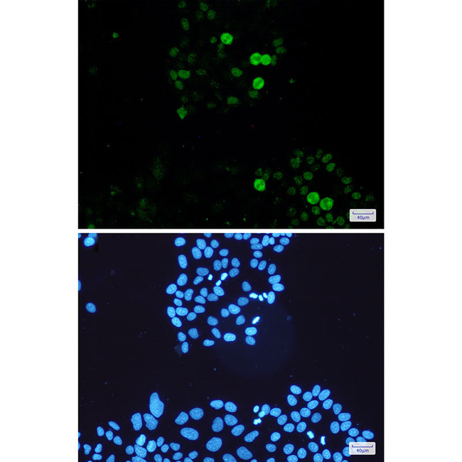 Phospho-c-Myc (Ser62) Antibody in Immunocytochemistry (ICC/IF)