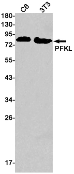 PFKL Antibody in Western Blot (WB)
