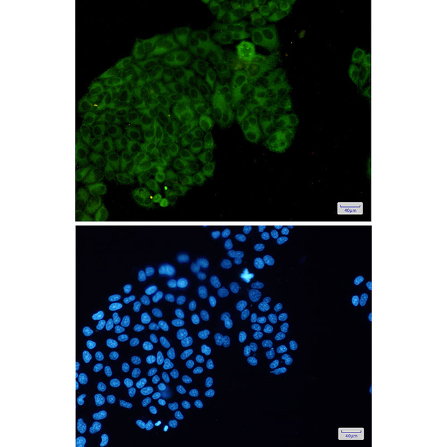 Phospho-PAK1/2/3 (Ser144, Ser141, Ser154) Antibody in Immunocytochemistry (ICC/IF)