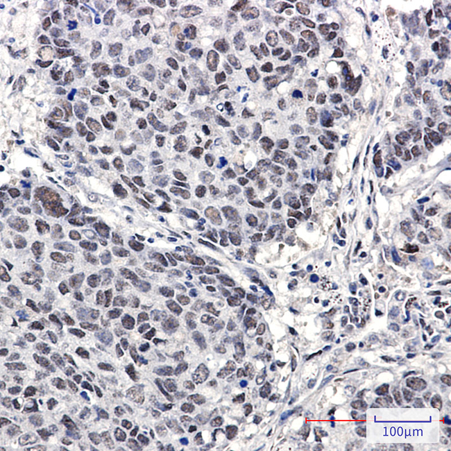 Cullin 4A/4B Antibody in Immunohistochemistry (Paraffin) (IHC (P))