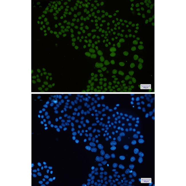 Histone Macro-H2A.1 Antibody in Immunocytochemistry (ICC/IF)