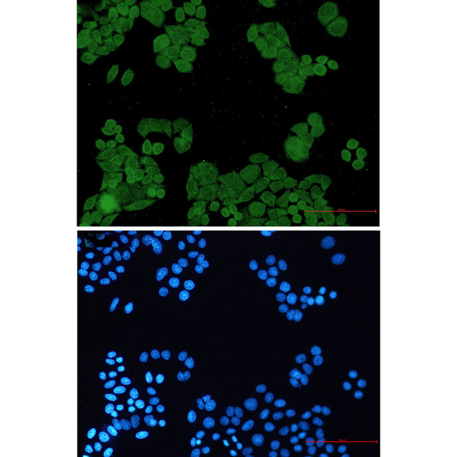 PP2A alpha/beta Antibody in Immunocytochemistry (ICC/IF)