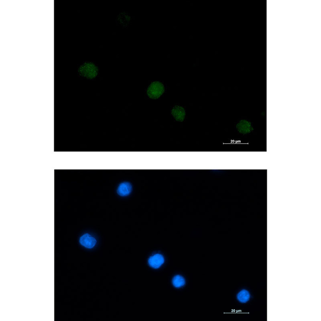 Galectin 14 Antibody in Immunocytochemistry (ICC/IF)