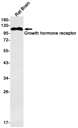 Growth Hormone Receptor Antibody in Western Blot (WB)