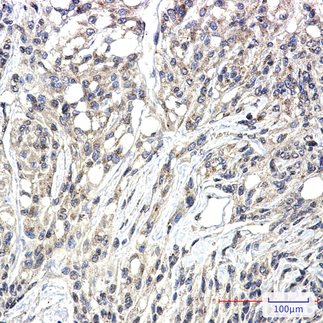 Phospho-PKC zeta/gamma (Thr410, Thr412) Antibody in Immunohistochemistry (Paraffin) (IHC (P))