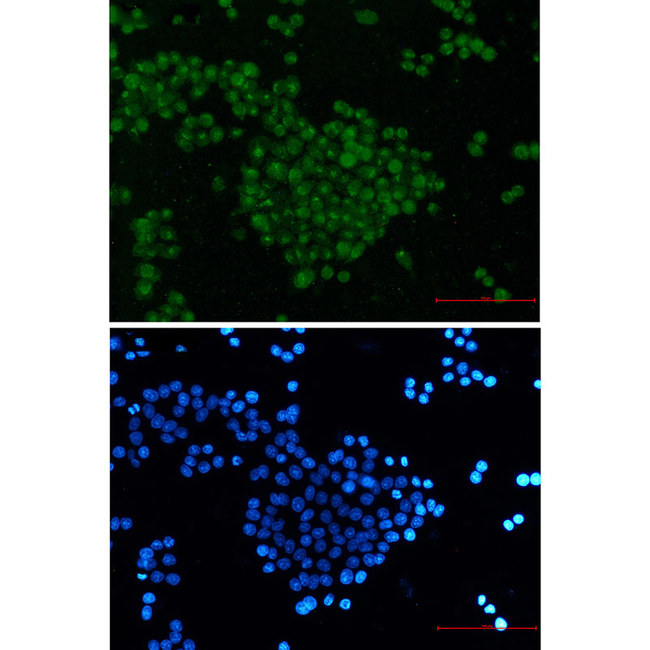 SKP2 Antibody in Immunocytochemistry (ICC/IF)
