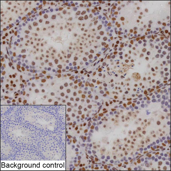 PBRM1 Antibody in Immunohistochemistry (Paraffin) (IHC (P))