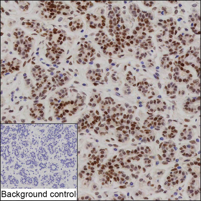 BRCA1 Antibody in Immunohistochemistry (Paraffin) (IHC (P))