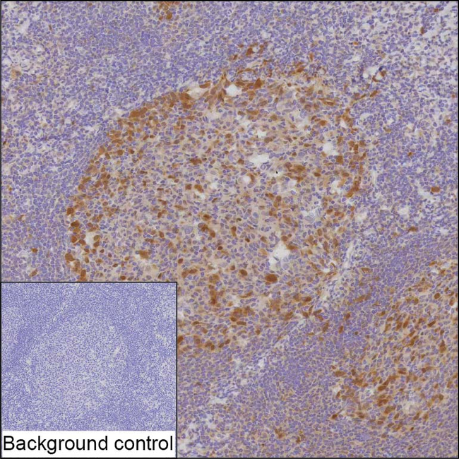 CDK2 Antibody in Immunohistochemistry (Paraffin) (IHC (P))