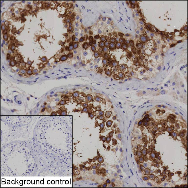 DPEP3 Antibody in Immunohistochemistry (Paraffin) (IHC (P))