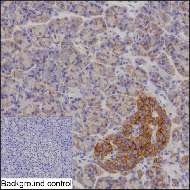 ENT1 Antibody in Immunohistochemistry (Paraffin) (IHC (P))