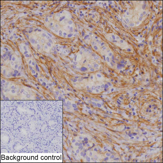 ROR2 Antibody in Immunohistochemistry (Paraffin) (IHC (P))