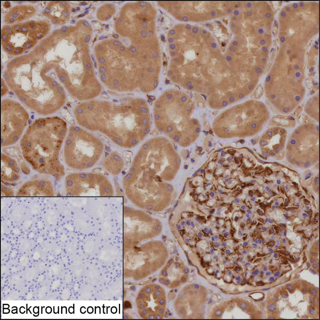 TRIM73 Antibody in Immunohistochemistry (Paraffin) (IHC (P))