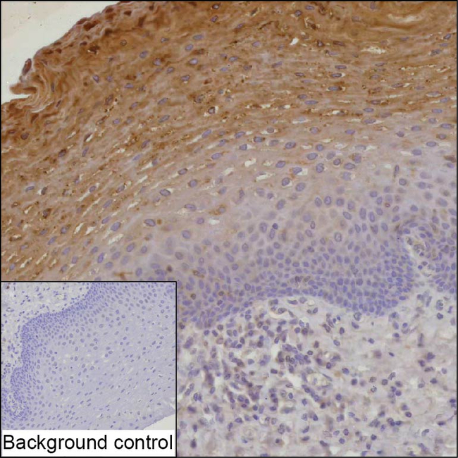 ECM1 Antibody in Immunohistochemistry (Paraffin) (IHC (P))