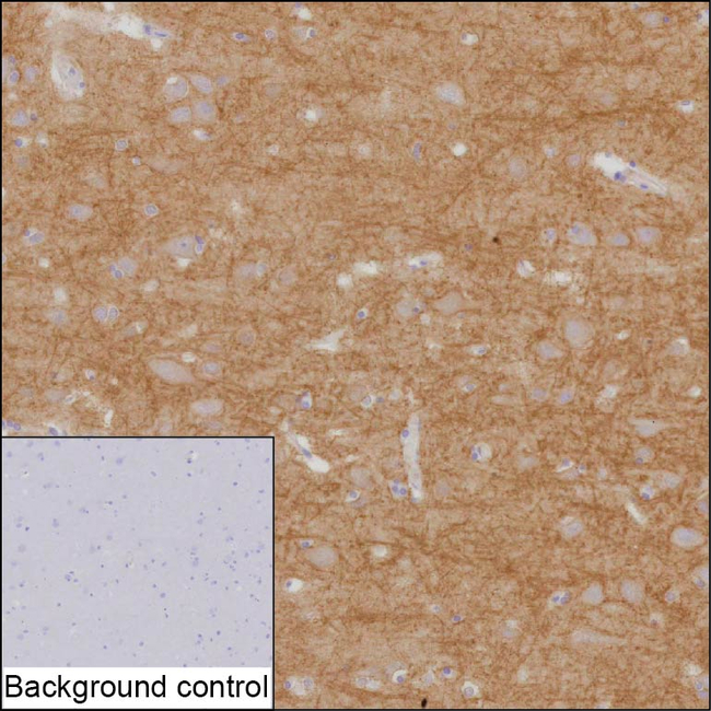 Spectrin beta-3 Antibody in Immunohistochemistry (Paraffin) (IHC (P))