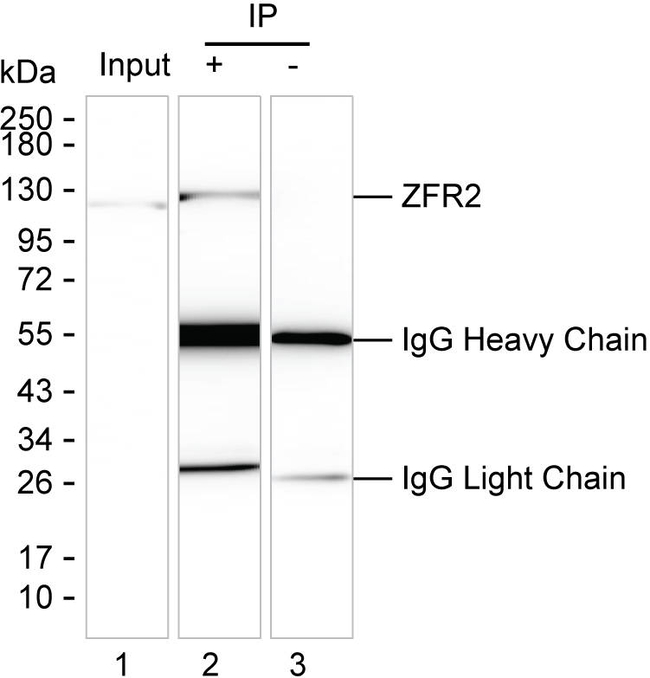 ZFR2 Antibody in Immunoprecipitation (IP)