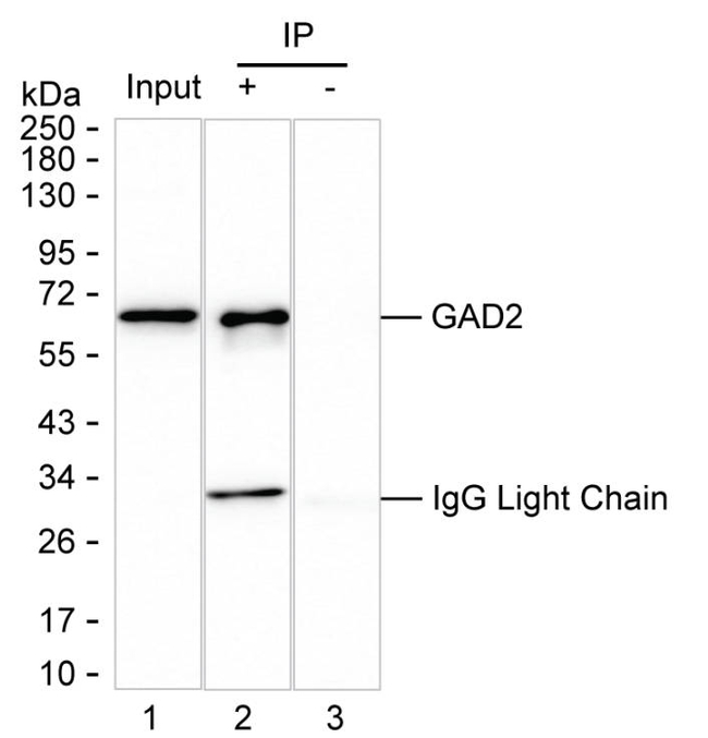 GAD65 Antibody in Immunoprecipitation (IP)