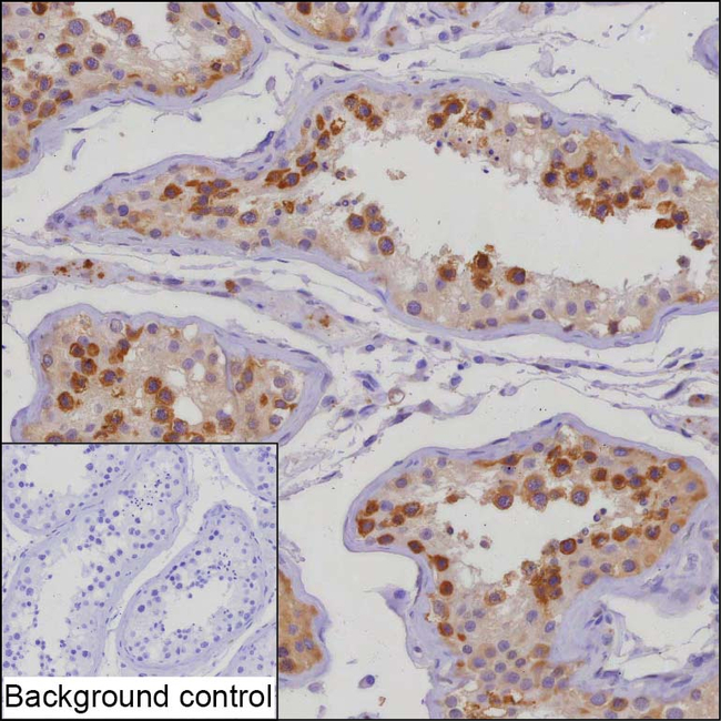 RAB41 Antibody in Immunohistochemistry (Paraffin) (IHC (P))