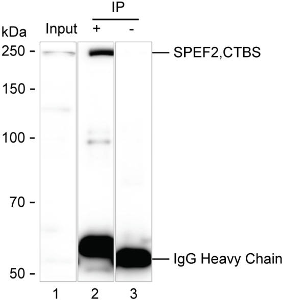 SPEF2 Antibody in Immunoprecipitation (IP)