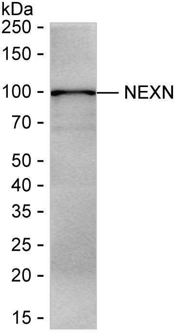 NEXN Antibody in Western Blot (WB)
