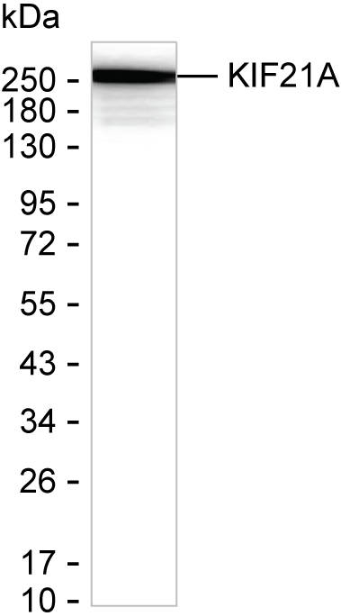 KIF21A Antibody in Western Blot (WB)