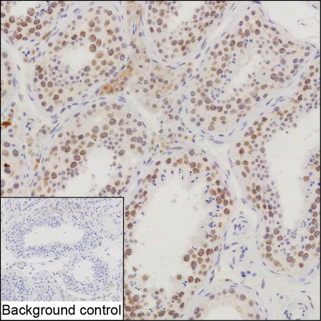NIPA Antibody in Immunohistochemistry (Paraffin) (IHC (P))