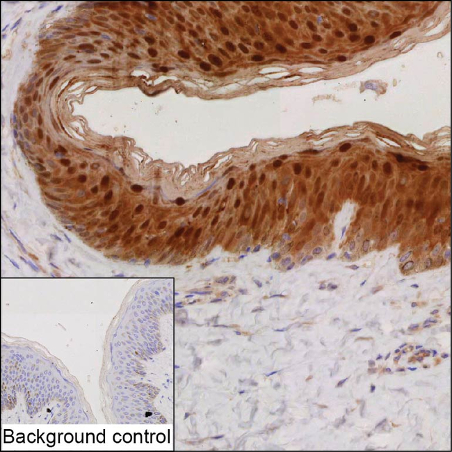 Caspase 14 Antibody in Immunohistochemistry (Paraffin) (IHC (P))