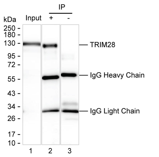 TRIM28 Antibody in Immunoprecipitation (IP)