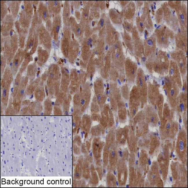 Cyclin D2 Antibody in Immunohistochemistry (Paraffin) (IHC (P))