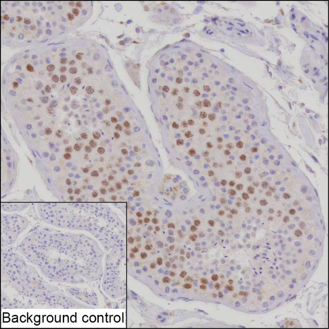 SCP3 Antibody in Immunohistochemistry (Paraffin) (IHC (P))