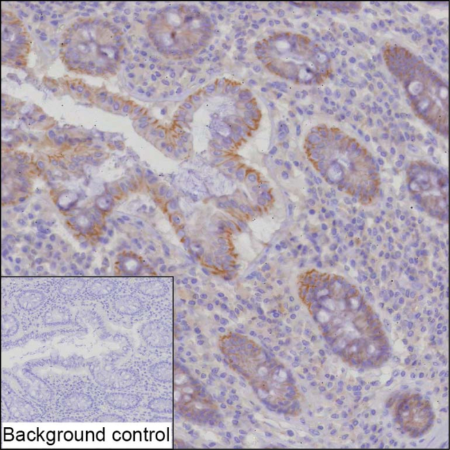 SCRIB Antibody in Immunohistochemistry (Paraffin) (IHC (P))