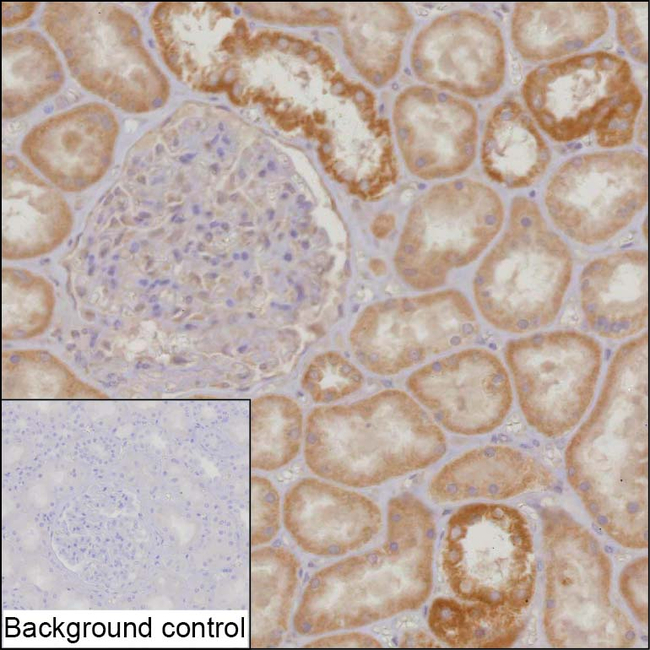 HLCS Antibody in Immunohistochemistry (Paraffin) (IHC (P))