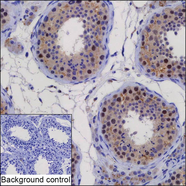 PSMC3IP Antibody in Immunohistochemistry (Paraffin) (IHC (P))