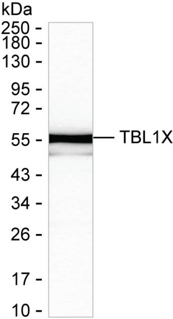 TBL1X Antibody in Western Blot (WB)