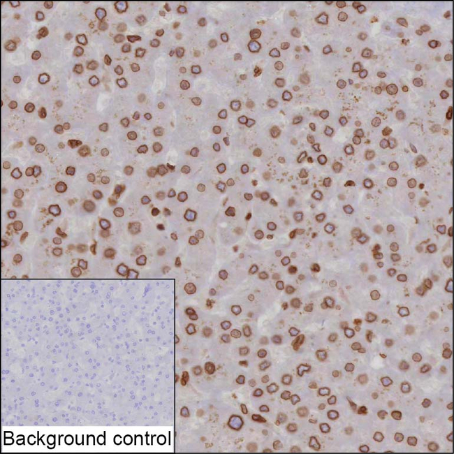 TOR1AIP1 Antibody in Immunohistochemistry (Paraffin) (IHC (P))