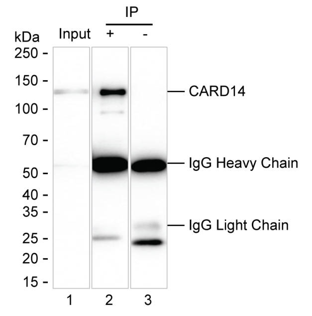 CARD14 Antibody in Immunoprecipitation (IP)