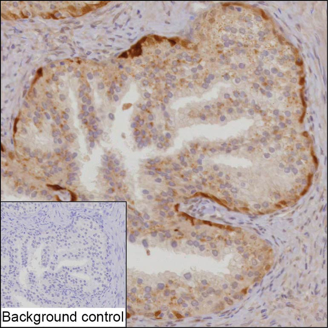 SRM Antibody in Immunohistochemistry (Paraffin) (IHC (P))