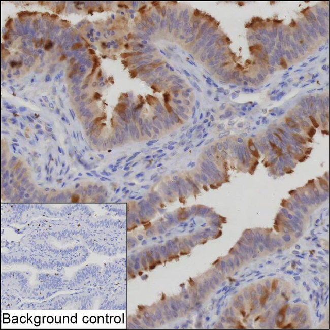 KIAA1751 Antibody in Immunohistochemistry (Paraffin) (IHC (P))