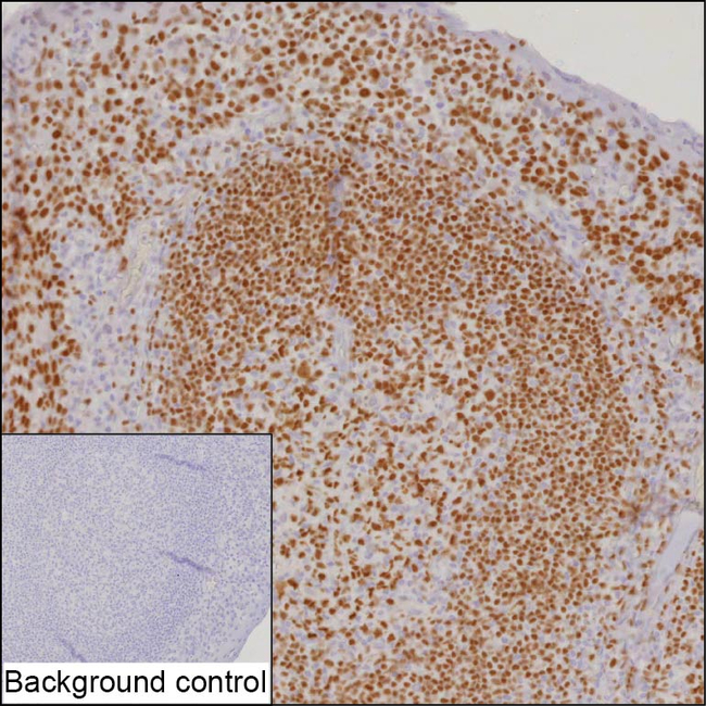 BCL11A Antibody in Immunohistochemistry (Paraffin) (IHC (P))